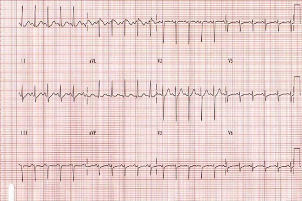 Кракен наркота что это